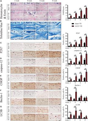 IRE1-mTOR-PERK Axis Coordinates Autophagy and ER Stress-Apoptosis Induced by P2X7-Mediated Ca2+ Influx in Osteoarthritis